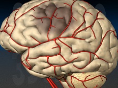 Нарушение мозгового кровообращения это нарушение кровообращения в системе сосудов головного и спинного мозга